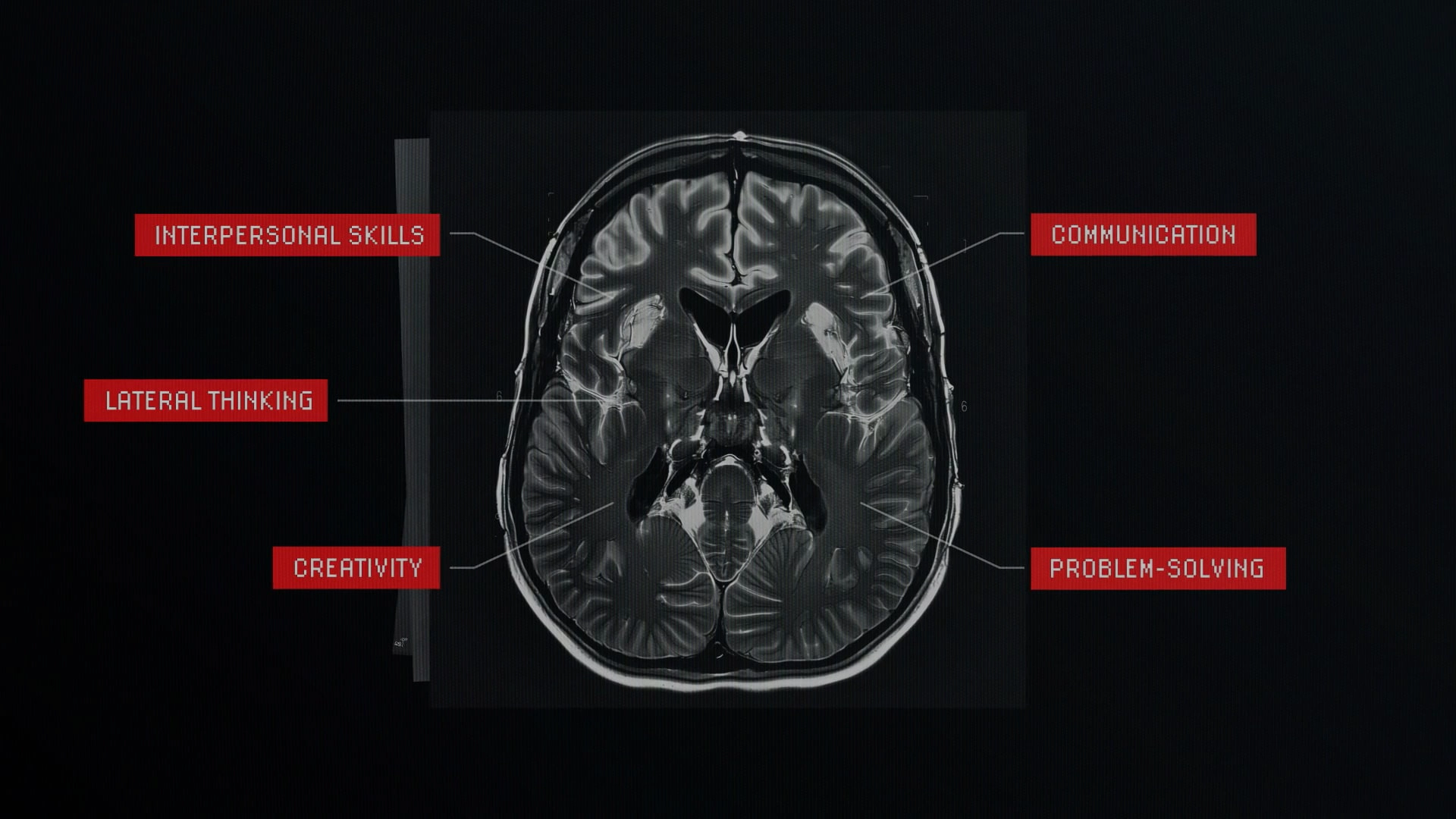 THE UNIVERSITY OF DYSLEXIC THINKING